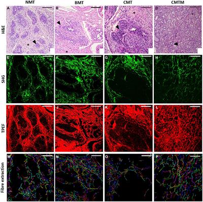 Collagen modifications predictive of lymph node metastasis in dogs with carcinoma in mixed tumours